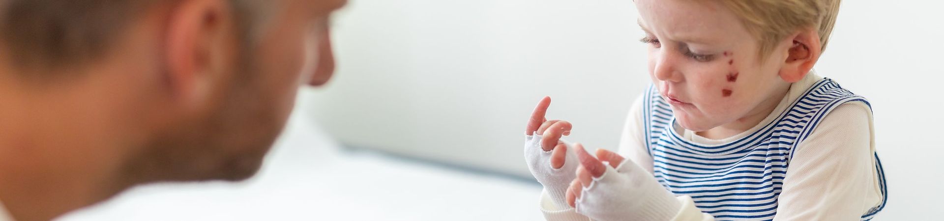 Child with EB with dressings on hands and arms sitting in front of a care taker