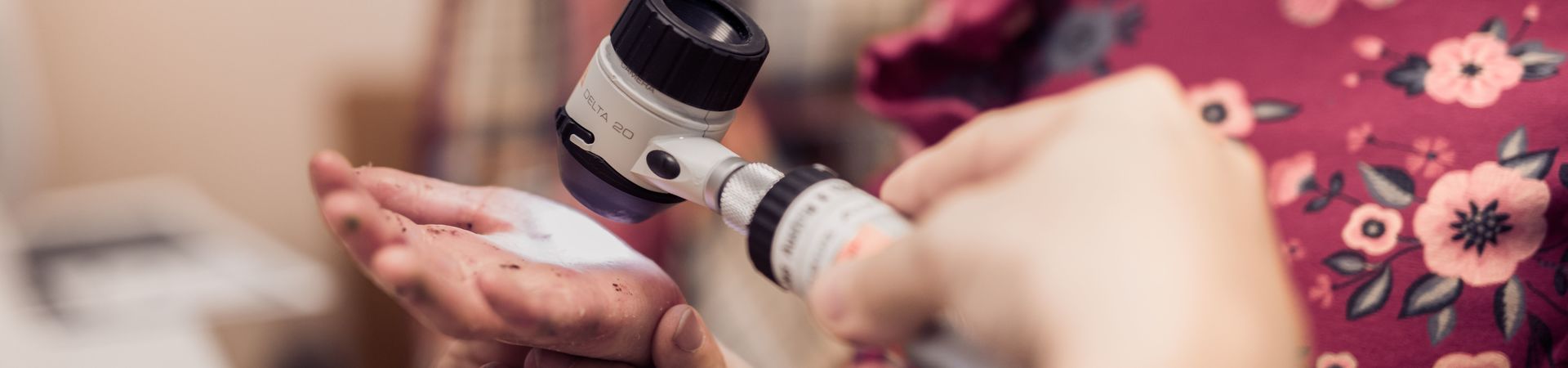 Hand of child with epidermolysis bullosa being examined by a doctor with an reflecting microscope